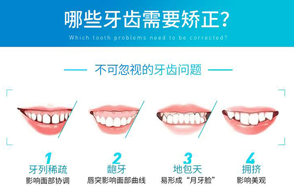那些牙齿需要矫正