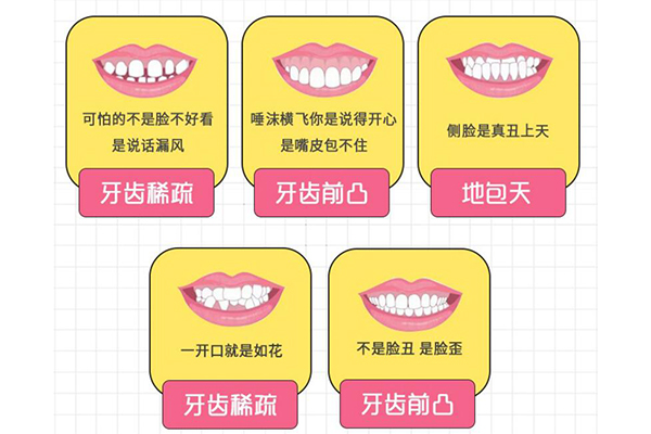 牙齿矫正类型