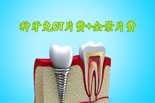 种植牙优惠