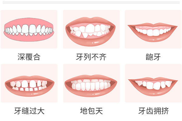 牙齿矫正