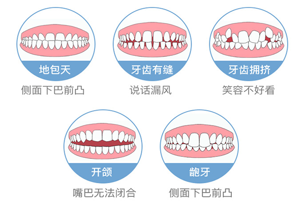 牙齿不齐