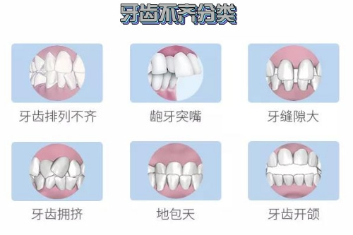 合肥整牙医院、整牙价格表