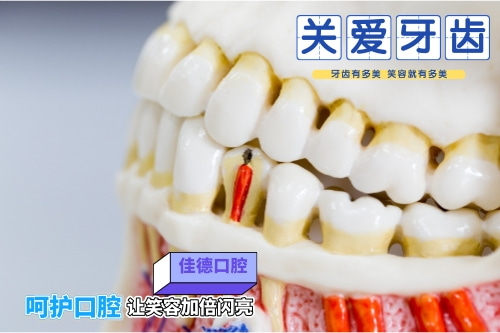 合肥种植牙、合肥佳德口腔