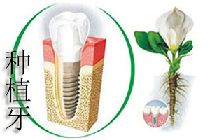 合肥做种植牙后如何护理