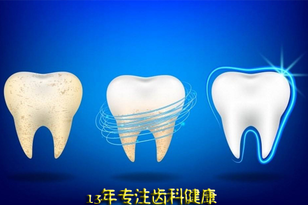 合肥全口牙种植需要多少钱？