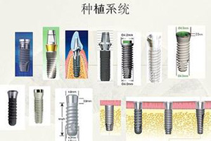 种植牙流程是怎么样的？