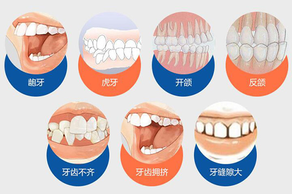 牙齿矫正价格表