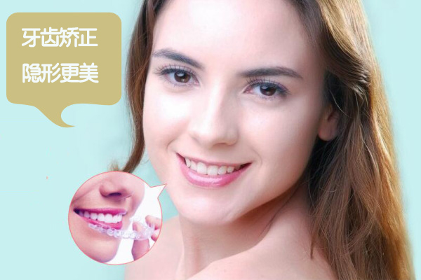 隐形牙套价格