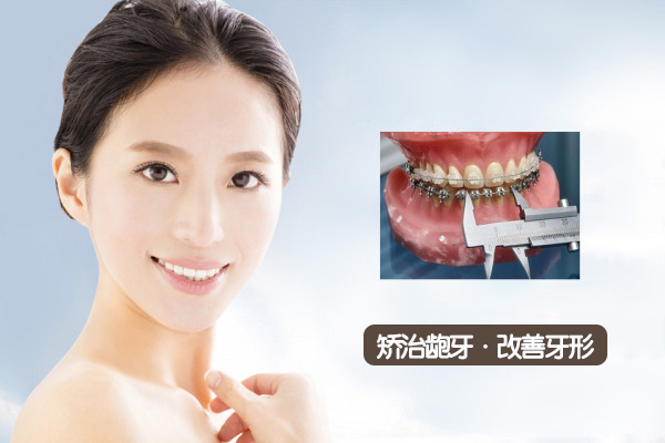 牙颌面畸形怎么矫正