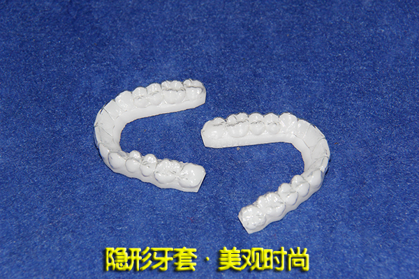 合肥牙套价格
