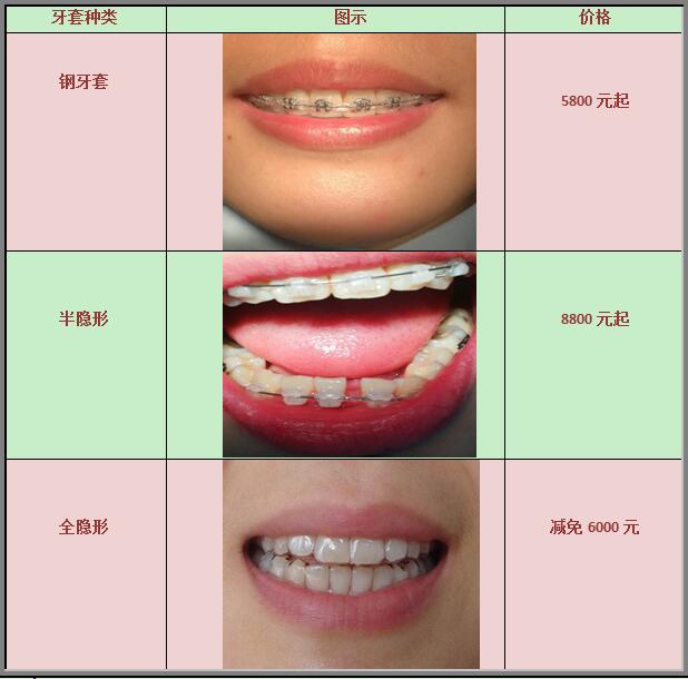合肥佳德口腔整牙价格