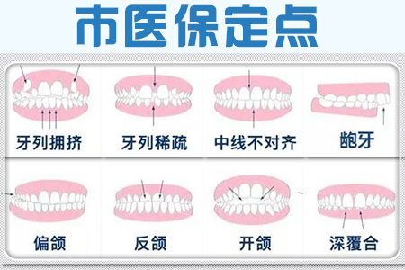 合肥牙齿矫正价格