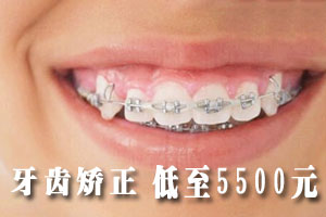 合肥牙齿矫正优惠活动