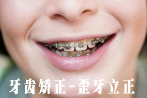 合肥哪家医院整牙好