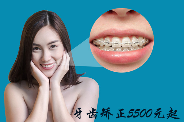 合肥牙科正畸多少钱