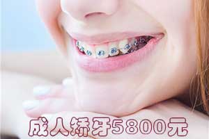 合肥牙齿矫正,牙齿矫正医院