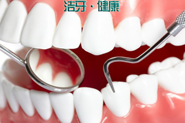 洗牙大概多少钱