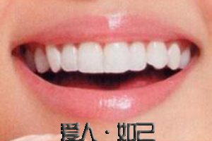 洗牙的优点
