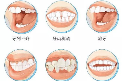 合肥牙齿矫正价格多少