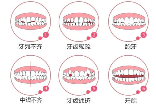 合肥整牙哪家医院好