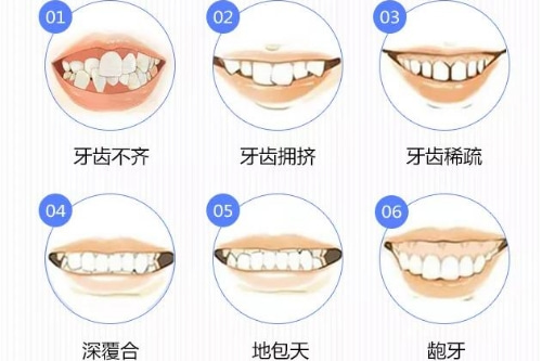 合肥牙齿矫正价格多少