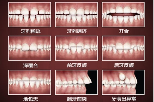 合肥牙齿矫正哪里好