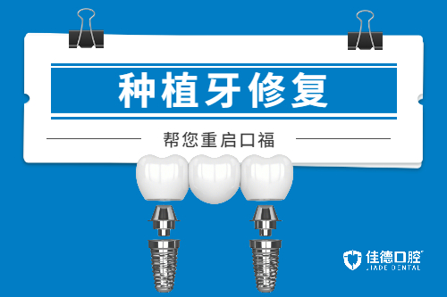 合肥种植牙价目表